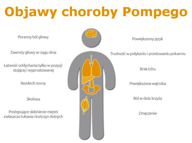 uproszczona sulwetka człowieka z napisem: Objawy choroby Pompego: poranny ból głowy, zawroty głowy w ciągu dnia, łatwość oddychania tylko w pozycji stojącej i wyprostowanej, bezdech nocny, skolioza, postępujące słabnięcie mięśni - zwłaszcza tułowia i kończyn dolnych, powiększony język, trudność w połykaniu, brak tchu, powiększona wątroba, ból w dole krzyża, zmęczenie