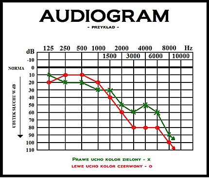 audiogram ubytku słuchu 2